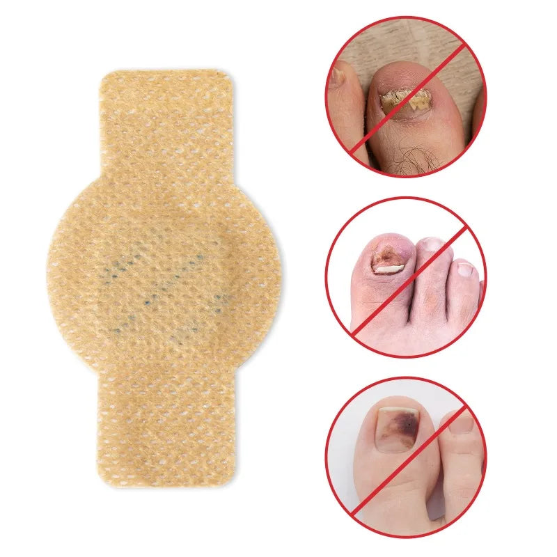 Plasturi Reparare Unghii Picioare